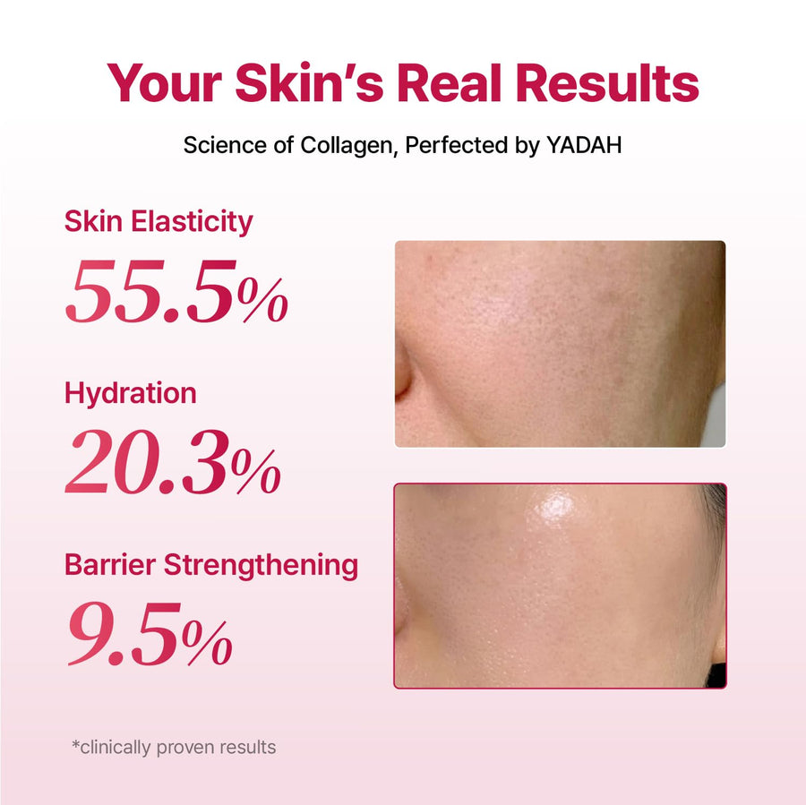 Clinical results for YADAH Collagen Hydra Core Cream skin elasticity and hydration